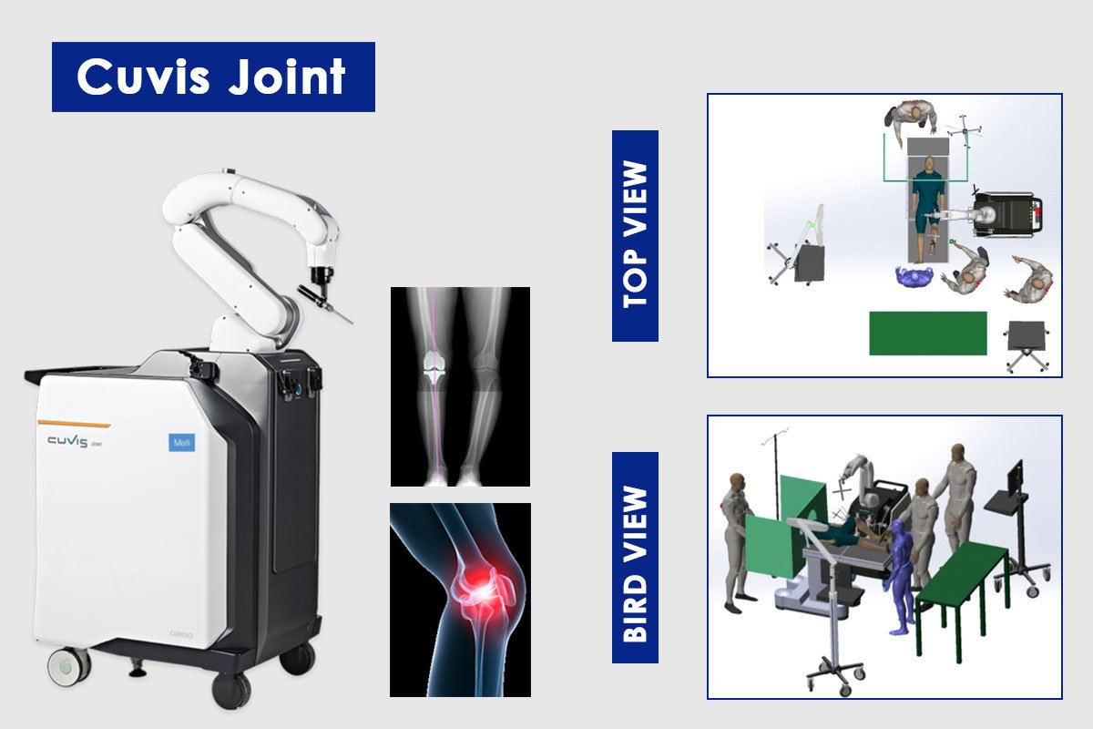 Cuvis Joint