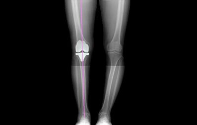 Cuvis Joint - Precise Cutting For Sub Millimeter