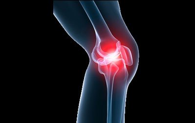 Cuvis Joint - Reduction of Side Effect