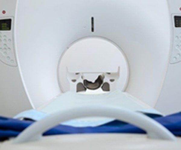 Cuvis Joint - CT Scan