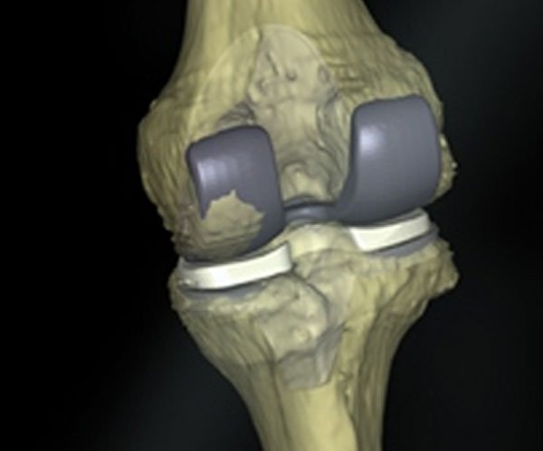 Cuvis Robotic - Pre Surgical Planning